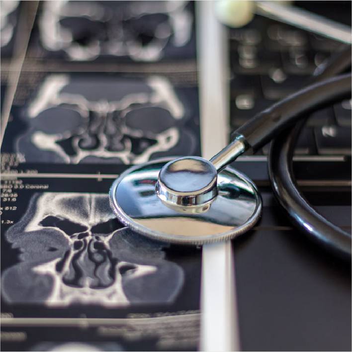 Image of a stethoscope laying on top of C T scans.